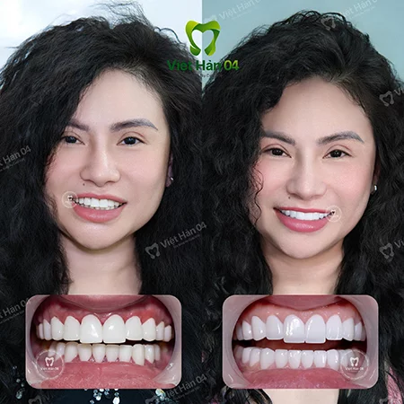 Nha khoa Việt Nam không thua gì bên hải ngoại