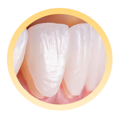 Bước 4