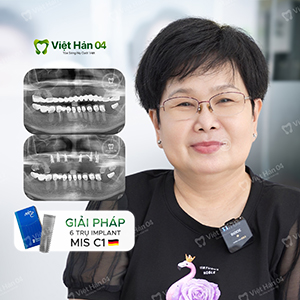 Khách hàng Cẩm Loan - Việt kiều Đài Loan