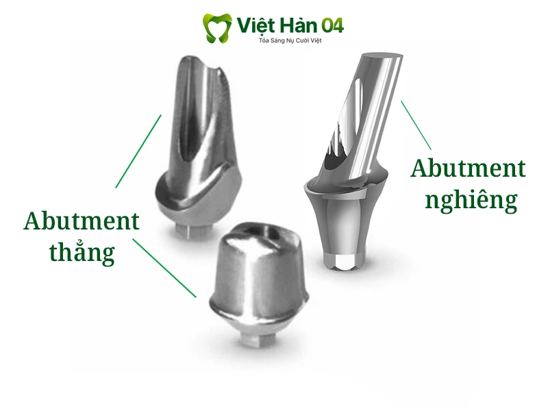 Phân loại Abutment theo hình dáng