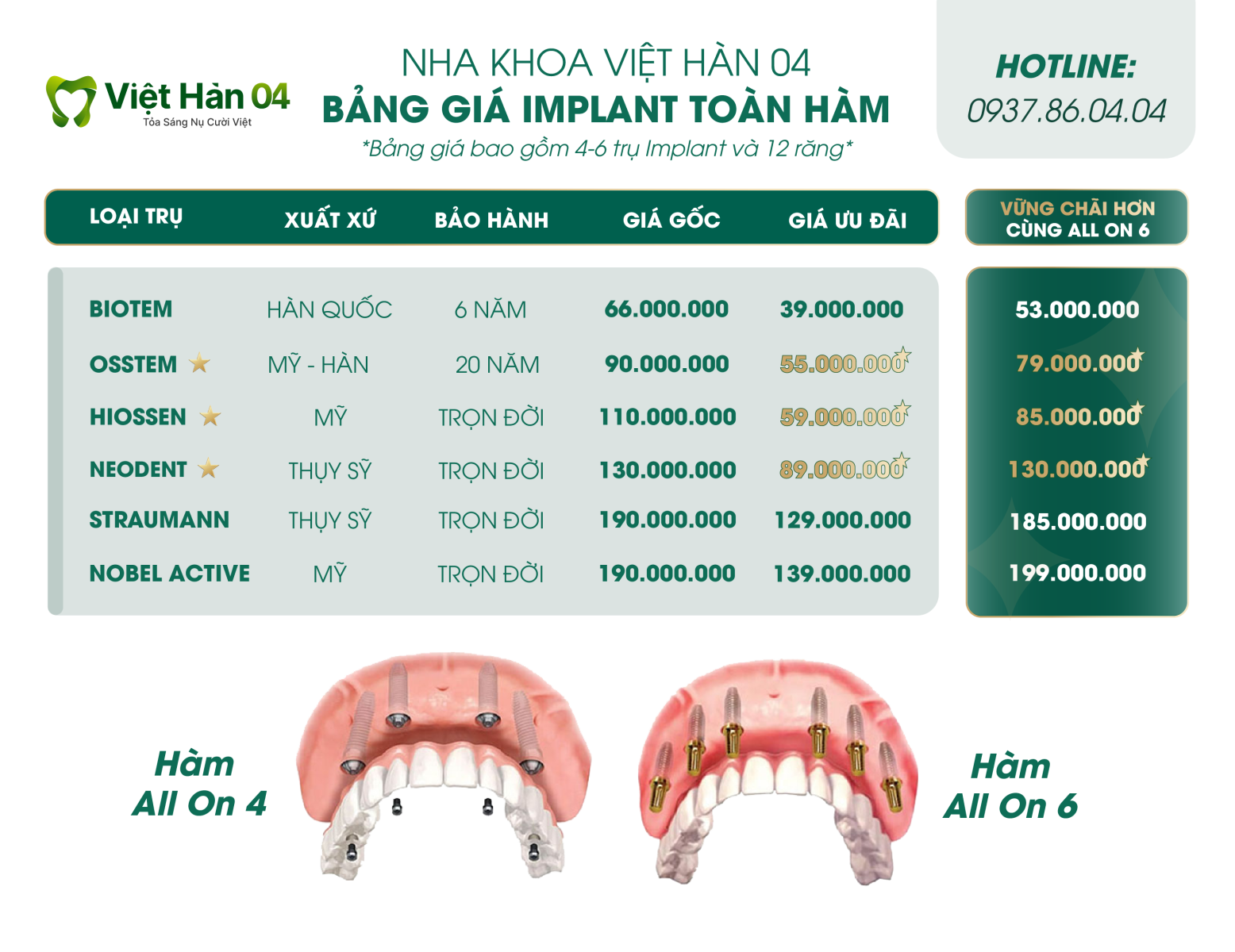 Hình ảnh bảng giá cấy ghép Implant nguyên hàm all on 4 - all on 6 tại nha khoa Việt Hàn 04