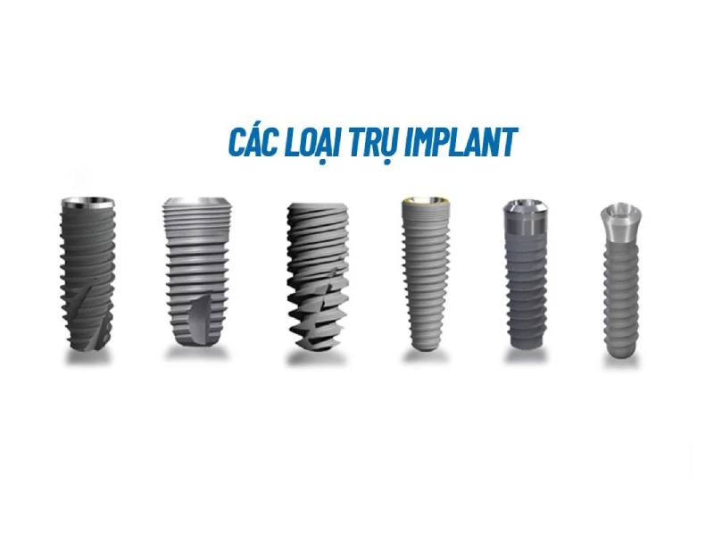 Các loại trụ Implant tại Nha khoa được nhập khẩu chính hãng