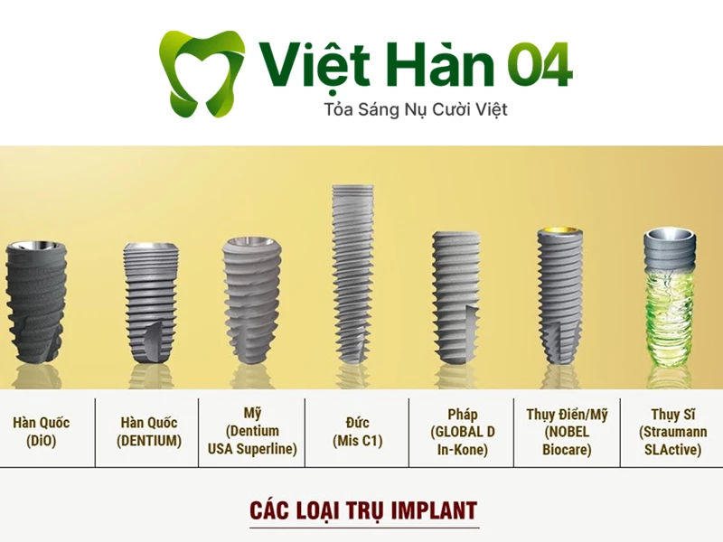 Các loại trụ Implant thế giới nổi tiếng hiện nay