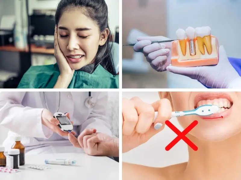 Các yếu tố làm tăng nguy cơ biến chứng khi trồng răng Implant