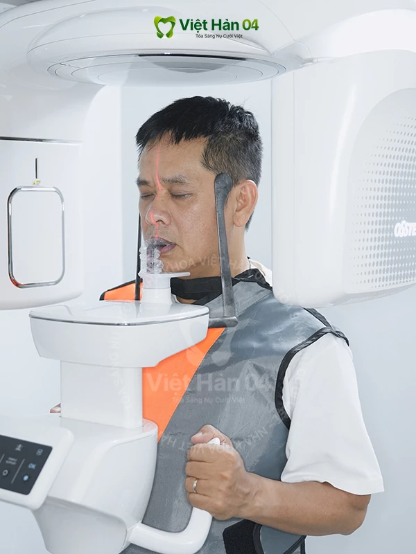 Chụp phim CT Cone Beam