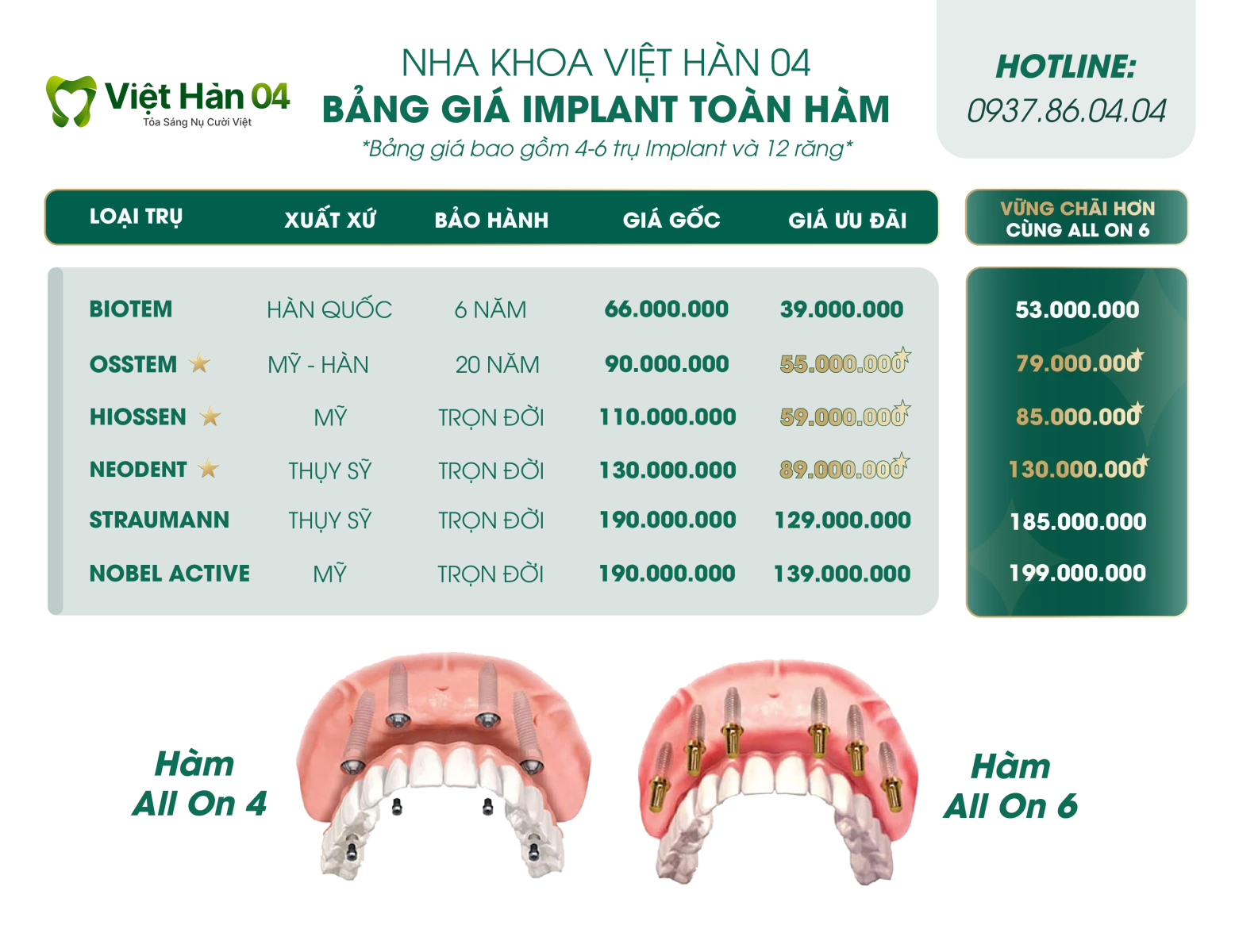 Bảng giá cho các trụ Implant nguyên hàm