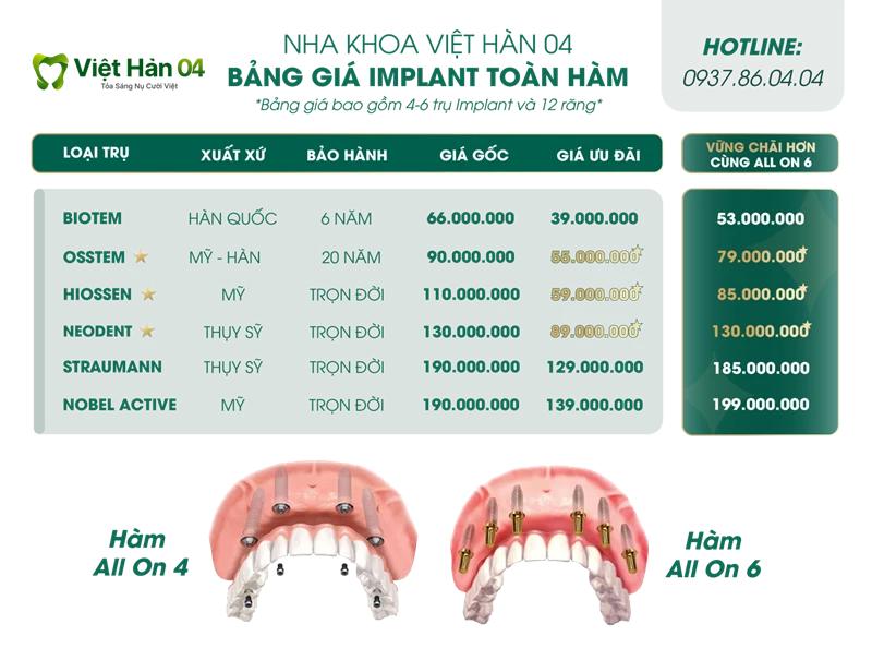 Bảng giá trồng răng implant nguyên hàm