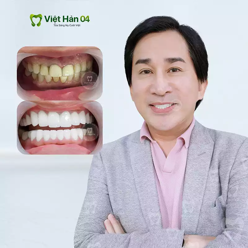 NSUT Kim Tử Long