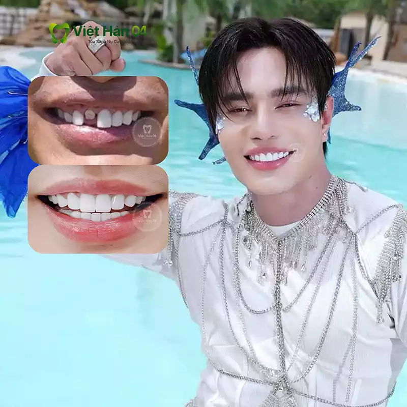 NS Lê Dương Bảo Lâm
