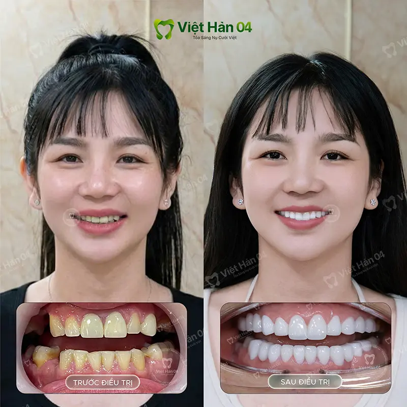 KH Quyền Trân