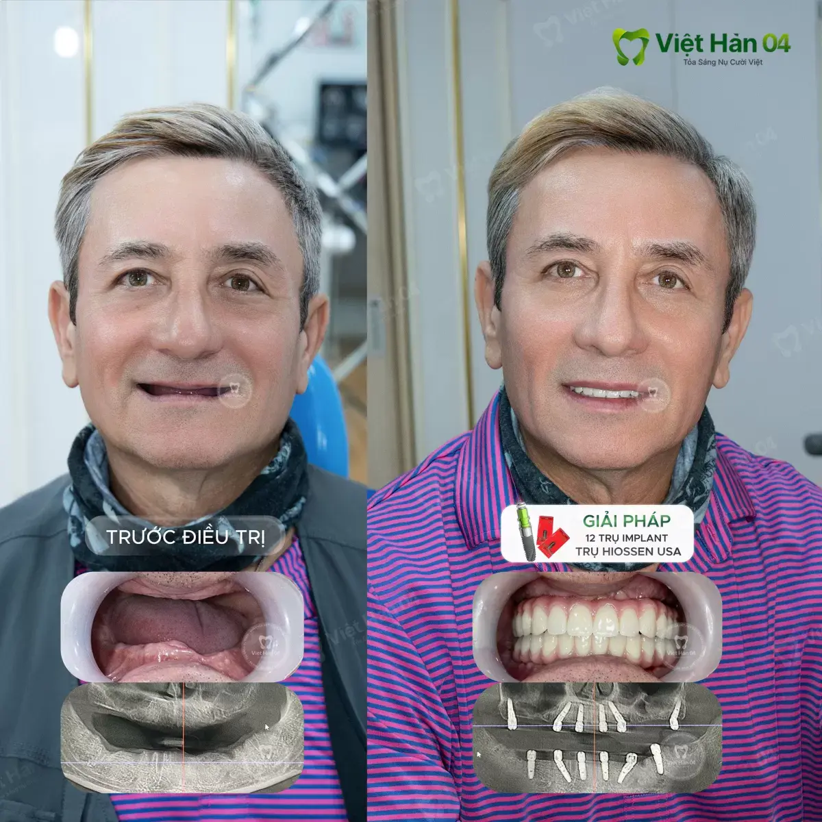 KH Philip Nguyễn - Việt kiều Mỹ