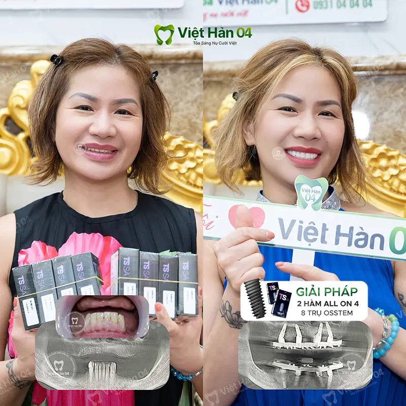 KH Laura Nguyễn - Việt kiều Mỹ