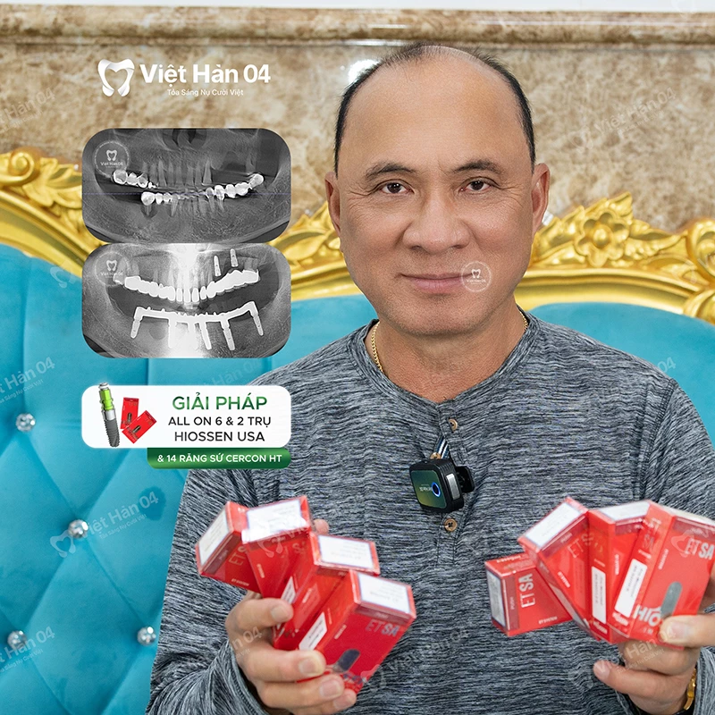 Khách hàng Tommy Vương - Việt Kiều Mỹ - Cấy ghép Implant toàn hàm tại Nha khoa Việt Hàn 04