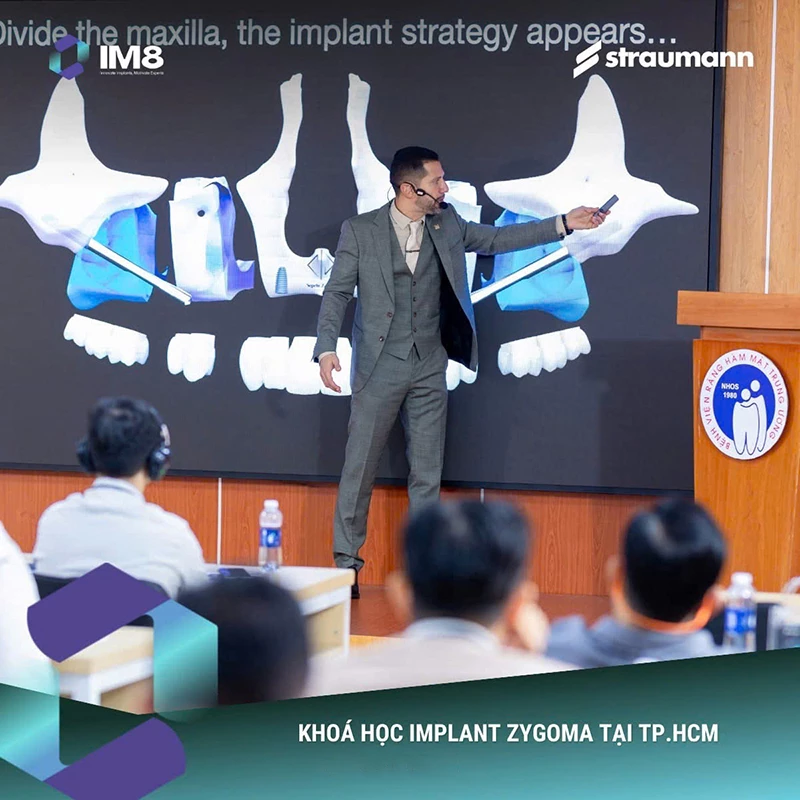 Khóa học Implant Zygoma