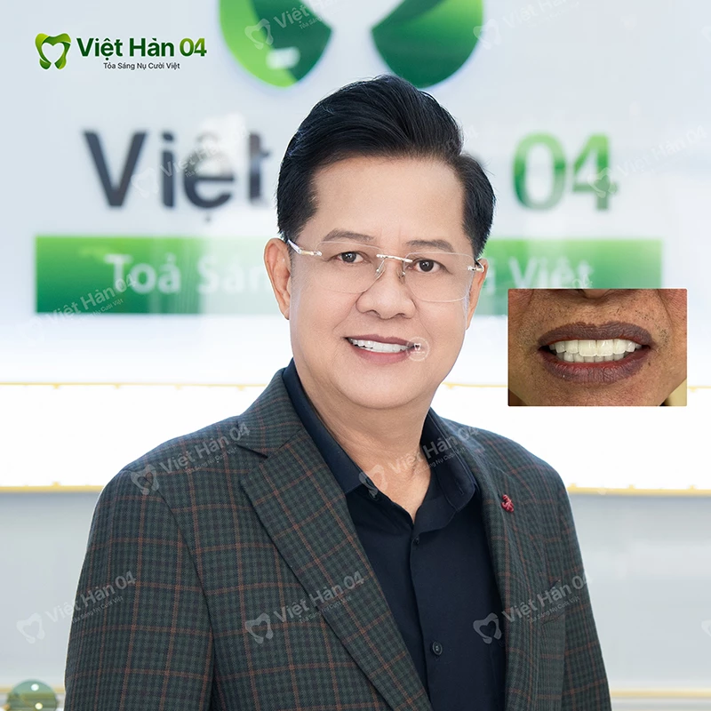 Nghệ sĩ Thanh Nam làm răng sứ tại nha khoa Việt Hàn 04