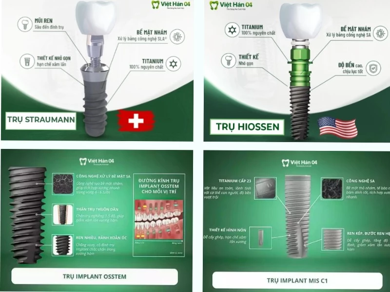 Sử dụng dòng trụ implant chất lượng, an toàn