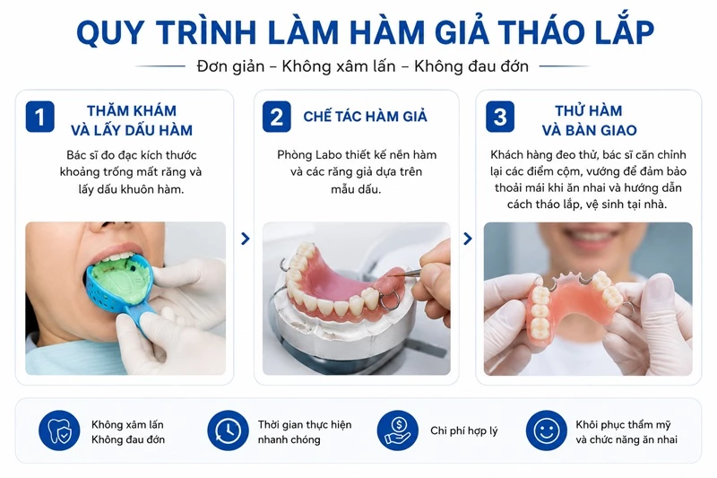 Quy trình làm hàm giả tháo lắp nhanh chóng