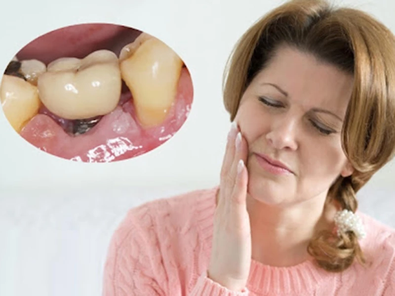 Đau nhức kéo dài: Dấu hiệu của việc dây thần kinh bị tổn thương do cấy sai vị trí hoặc sai kích thước trụ.