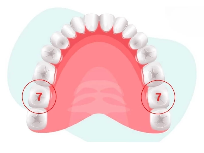 Răng số 7 vĩnh viễn bắt đầu mọc ở trẻ từ 12 đến 13 tuổi 