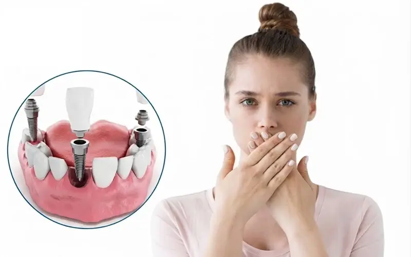 Tình trạng hôi miệng kéo dài sau trồng răng Implant