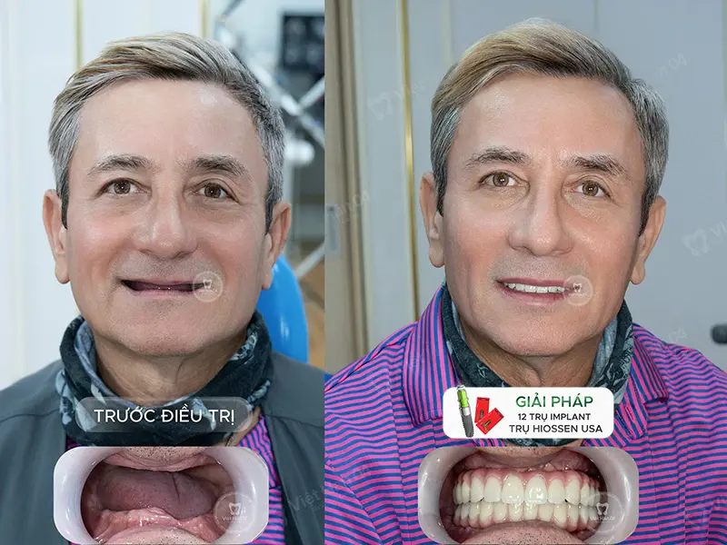 Giúp khách hàng tự tin trong cuộc sống hơn với nụ cười mới