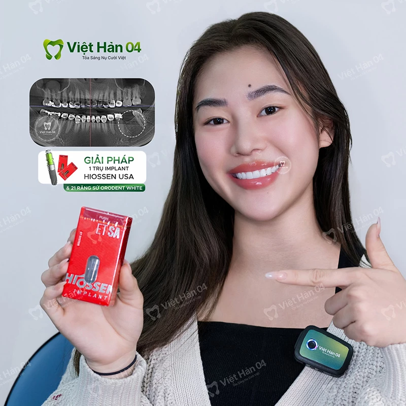 Tại sao cắm implant phải đủ 18 tuổi?