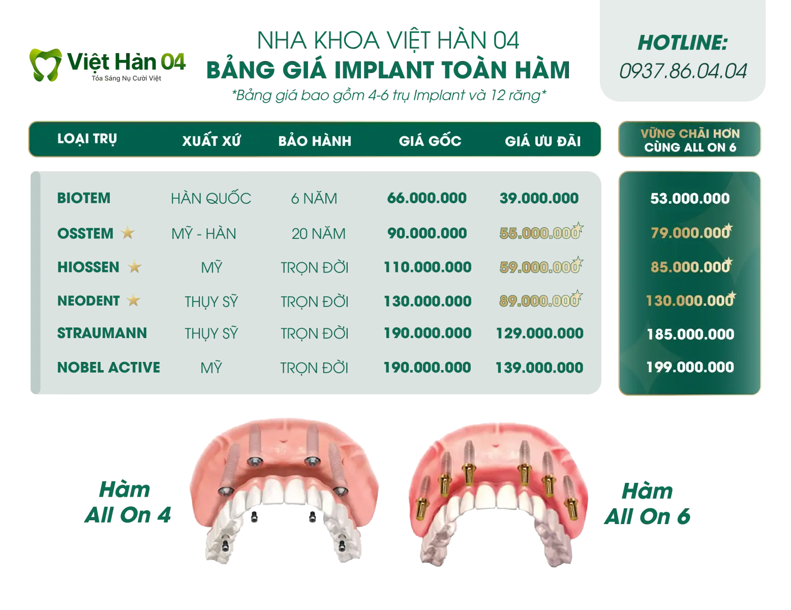 Bảng giá Implant toàn hàm All On 4 - All On 6