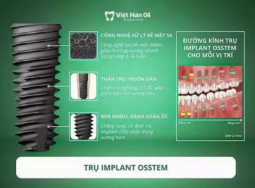 Trụ implant OSSTEM giúp tích hợp xương hàm nhanh từ 4 - 6 tuần
