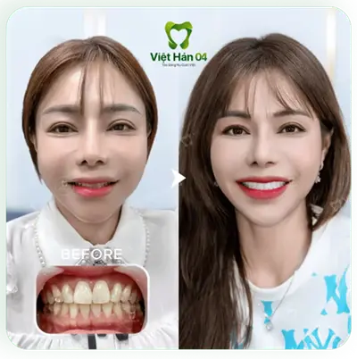 Khách hàng Hằng Nga