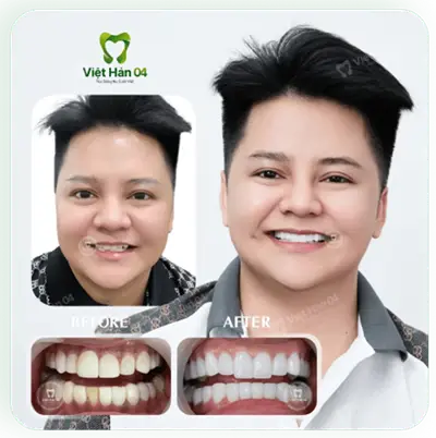 Khách hàng Roy Nguyễn