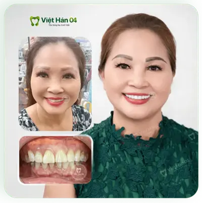 Khách hàng Trâm Anh