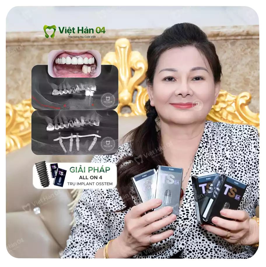 Khách hàng Tuyết Ngọc