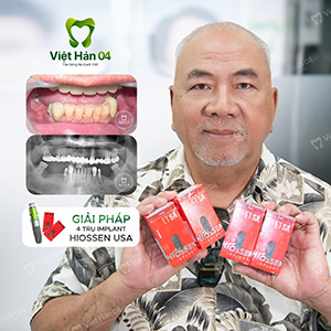 Khách hàng Tân Đoàn - Việt kiều Mỹ