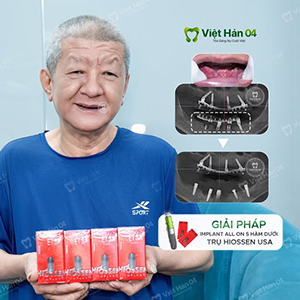 Khách hàng Thái Tùng - Việt kiều Đài Loan