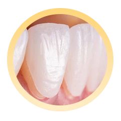 Bước 4