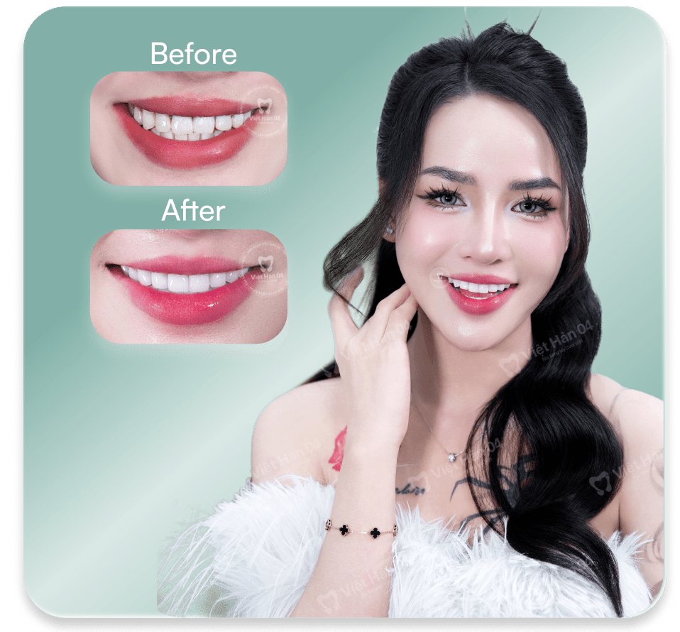 TIKTOKER TRIỆU DI TÚ