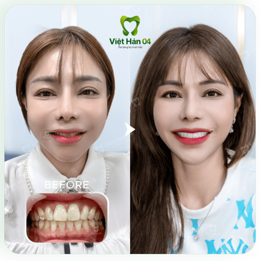 Khách hàng Hằng Nga